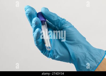 Die Hand eines medizinischen Mitarbeiters in einem sterilen Handschuh hält ein sauberes Blutteströhrchen Stockfoto