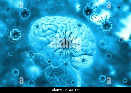 Virusinfektion am Gehirn. 3D-Abbildung Stockfoto