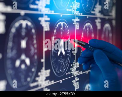 Arzt sieht einen Gehirnscan des Patienten auf dem Bildschirm an Stockfoto