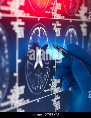 Arzt sieht einen Gehirnscan des Patienten auf dem Bildschirm an Stockfoto