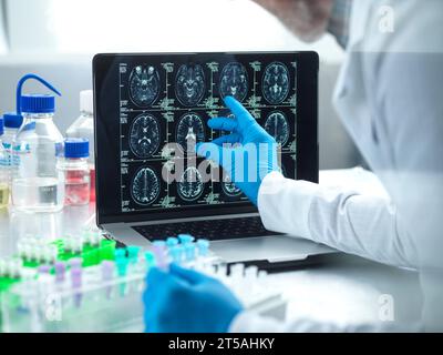 Neurologische Forschung, konzeptuelles Bild Stockfoto