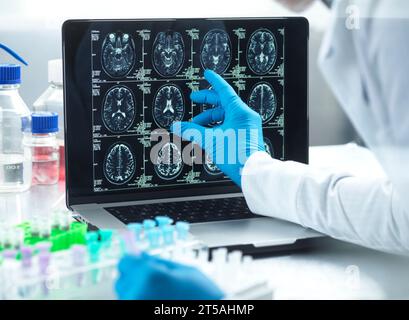 Neurologische Forschung, konzeptuelles Bild Stockfoto