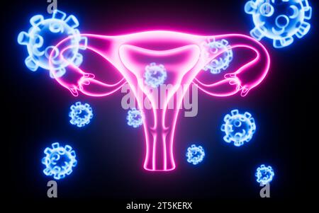 Virusattacke Uterus, hpv-Infektion, weibliches Fortpflanzungssystem, 3D-Rendering. 3D-Abbildung. Stockfoto