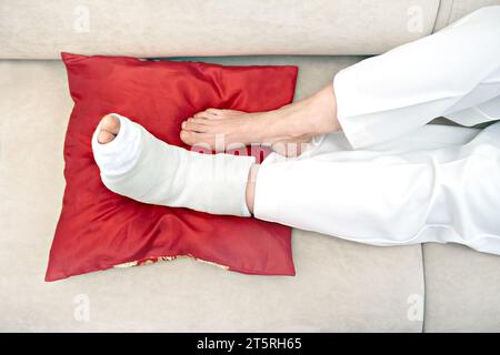 Weiblicher gebrochener Fuß in weißem Gips auf einem roten Kissen liegend. Verletzung, Trauma, Genesung, Rehabilitation des Menschen Konzept. Therapie zu Hause f Stockfoto