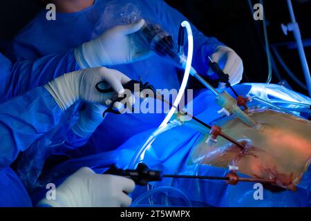 Ein Team von Chirurgen führt laparoskopische Operationen im OP durch, wobei Neonlichter den Bauch des Patienten beleuchten. Minimal-invasive Chirurgie. Selektiver Fokus. Stockfoto