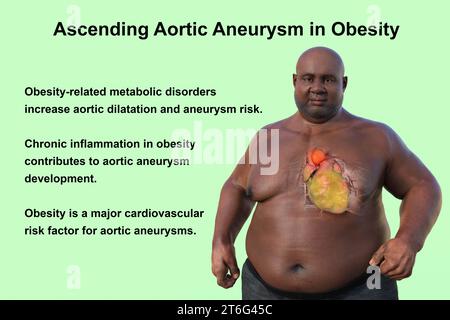 Wissenschaftliche 3D-Illustration, die einen adipösen Mann mit transparenter Haut zeigt und ein aufsteigendes Aortenaneurysma enthüllt, ein Konzept, das die assoziatio hervorhebt Stockfoto