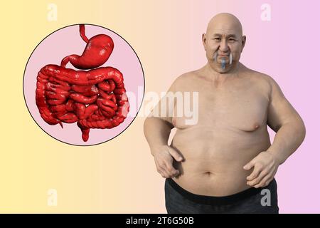 Eine detaillierte 3D medizinische Illustration eines übergewichtigen Mannes mit transparenter Haut, die das Verdauungssystem enthüllt und die Verdauungsprobleme hervorhebt Stockfoto