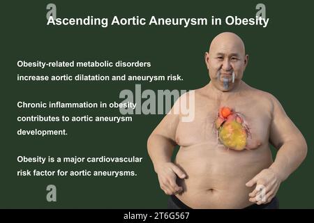 Wissenschaftliche 3D-Illustration, die einen adipösen Mann mit transparenter Haut zeigt und ein aufsteigendes Aortenaneurysma enthüllt, ein Konzept, das die assoziatio hervorhebt Stockfoto