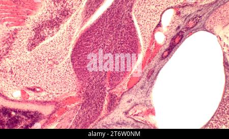 Mikroskopischer Schnitt durch den menschlichen Cochleakern. Histologischer Objektträger mit Hämatoxylin und Eosin (H&E) gefärbt. Stockfoto