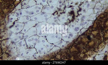 Einfaches Plattenepithel (Mesothel). Epithel, das Pleura, Peritoneum und Perikard auskleidet. Stockfoto