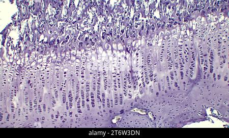 Knochenentwicklung an Stelle des Knorpelmodells. Die Wachstumsplatte besteht aus Knorpel, das aus proliferierenden Knorpelzellen besteht. Stockfoto
