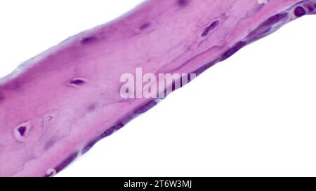 Lichtmikrogramm intramembranöser Ossifikation. Knochentrabekeln werden durch Osteoblasten gebildet, die ihre Oberfläche auskleiden.Hämatoxylin und Eosin Färbung Stockfoto