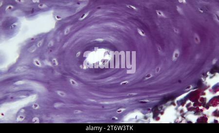 Querschnitt durch menschliches Knochenosteon und Haversischen Kanal. Histologischer Objektträger mit Hämatoxylin und Eosin (H&E) gefärbt. Stockfoto