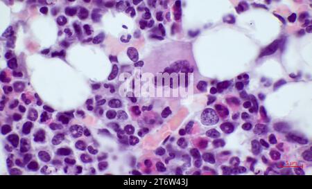 Die größte Zelle im roten Knochenmark ist der Megakaryozyten (in der Mitte). Hämatoxylin- und Eosin-Färbung. Vergrößerung - 1000. Stockfoto