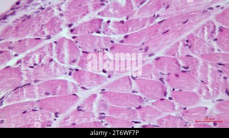 Lichtmikroskop eines Abschnitts durch den Skelettmuskel. Muskelfaserfaszikel. Hämatoxylin-endEosin-Färbung. Vergrößerung: x200 Stockfoto