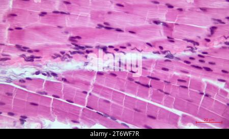 Lichtmikroskop eines Abschnitts durch den Skelettmuskel. Muskelfaserfaszikel. Hämatoxylin-endEosin-Färbung. Vergrößerung: x200 Stockfoto