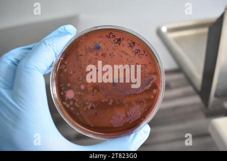Bakterienkolonien oder Bakterienwachstum auf Eosin-Methylenblau-Agar-Platte. Stockfoto