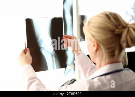 Röntgenfilme der Frau in der Hand halten Röntgenbilder aganistischer Krankenhaushintergrund. CT-Scans des Knochengesundheitskonzepts. Stockfoto