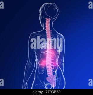 3D-Darstellung der Wirbelsäulenanatomie mit Schmerzen. Bild einer transparenten Frau mit Skelett und inneren Organen auf blauem Hintergrund. Stockfoto