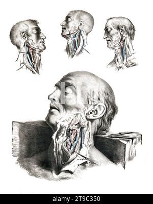 Menschliche Anatomie, Medizin, das Kreislaufsystem, Blutkreislauf, Medizin, menschliche Anatomie, Hals geöffnet, Halsschlagader, Speiseröhre, Vene, Kopf eines Mannes in vier Variationen. Kolorierte Lithographie von J. Maclise, 1841/1844, Historisch, digital restaurierte Reproduktion von einer Vorlage aus dem 19. Jahrhundert / menschliche Anatomie, Medizin, Kreislaufsystem, Blutkreislauf, Medizin, Anatomie des Menschen, Hals offen, A. carotis, Speiseröhre, Vene, Kopf eines Mannes in vier Variationen. Farbige Lithographie von J. Maclise, 1841/1844, historisch, digital restaurierte Reproduktion eines 19. Jahrhunderts Stockfoto