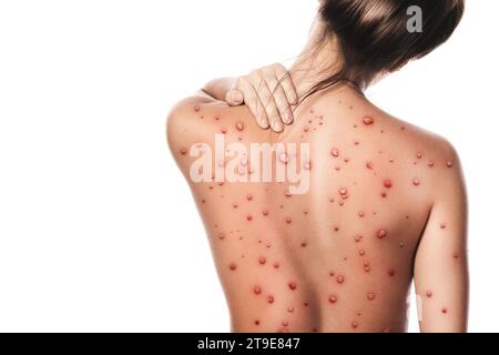 Frau mit Schmerzen im Rücken und Hals auf weißem Hintergrund Stockfoto