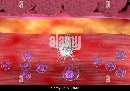 Entzündliche Haut bei Ekzem, atopischer Dermatitis (AD) - Draufsicht 3D-Illustration Stockfoto