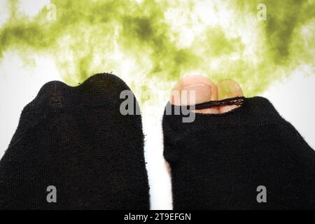 Männliche Füße in alten, stinkenden und dreckigen Socken Stockfoto