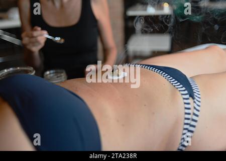 Therapeut wenden Bauchmoxibustion chinesische Medizin brennen Beifuß Moxa Rauchen Kegel Akupunktur Punkt 50s kaukasische fit Frau, Bauch Bauch Stockfoto