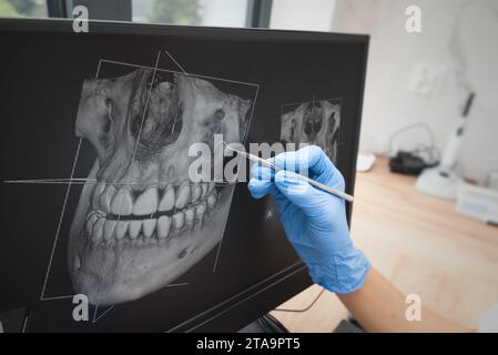 Zahnärztliche Beratung in der Klinik. Zahnarzt zeigt Zähne Röntgen auf digitalen Tablet-Bildschirm. 3D-Tomographie-Technologie. Stockfoto