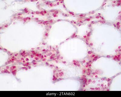 Menschliches Lungengewebe, leichte Mikrograph Stockfoto