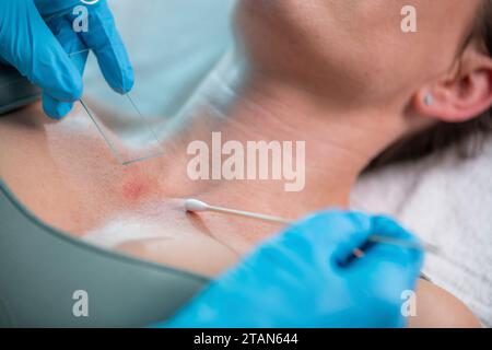 Dermatologe bei Hautprobe Stockfoto