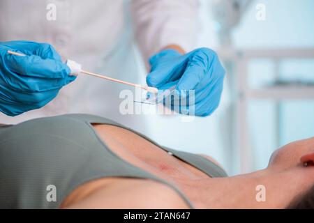 Dermatologe bei Hautprobe Stockfoto