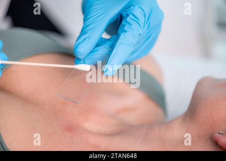 Dermatologe bei Hautprobe Stockfoto