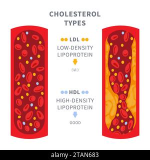 Cholesterinspiegel, konzeptuelle Darstellung Stockfoto