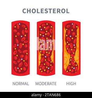 Cholesterinspiegel, konzeptuelle Darstellung Stockfoto