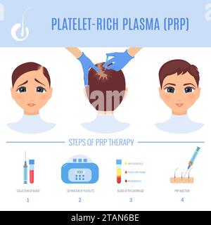PRP zur Haarausfallbehandlung, konzeptionelle Illustration Stockfoto