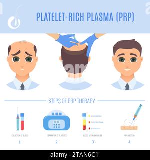 PRP zur Haarausfallbehandlung, konzeptionelle Illustration Stockfoto