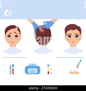 PRP zur Haarausfallbehandlung, konzeptionelle Illustration Stockfoto