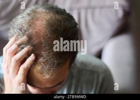 Nahaufnahme eines jungen 30-jährigen kaukasischen Mannes mit androgener Alopezie, der seinen Kopf berührt und sich Sorgen um Haarausfall macht. Stockfoto