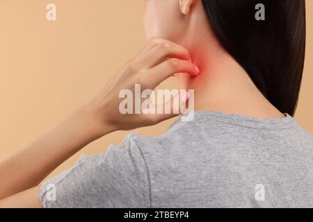 Leiden an Allergie. Junge Frau kratzt sich am Hals auf beigefarbenem Hintergrund, Rückansicht Stockfoto