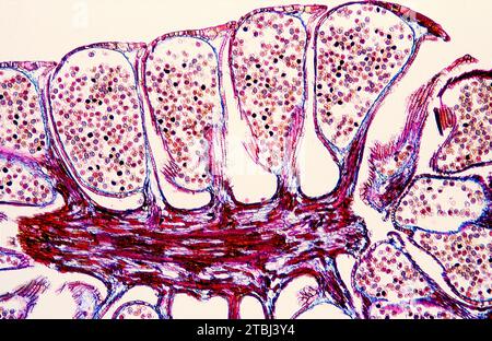 Kieferkegel oder Strobilus, der den Pollen zeigt. Optisches Mikroskop, Vergrößerung X40. Stockfoto