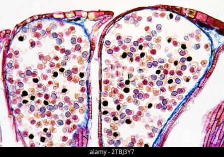 Kieferkegel oder Strobilus, der den Pollen zeigt. Optisches Mikroskop, Vergrößerung X100. Stockfoto