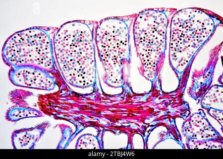 Männlicher Kiefernkegel (Pinus sp.) Zeigt Pollen. Optisches Mikroskop X40. Stockfoto