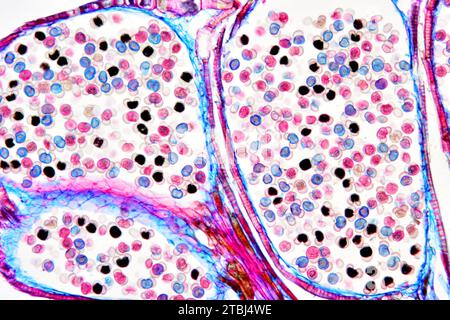 Männlicher Kiefernkegel (Pinus sp.) Zeigt Pollen. Optisches Mikroskop X100. Stockfoto
