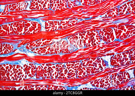 Skelettmuskulatur im Quer- und Längsschnitt von Schweinen mit Trichinose. Lichtmikroskop X150 mit einer Breite von 10 cm. Stockfoto