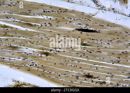 Skelettmuskulatur des Menschen im Längsschnitt. Lichtmikroskop X300 mit einer Breite von 10 cm. Stockfoto