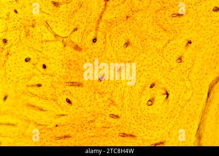 Kortikales Knochengewebe mit Haversischen Kanälen, Osteonen, Osteozyten und Mineralmatrix. Lichtmikroskop X150 mit einer Breite von 10 cm. Stockfoto