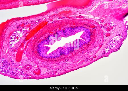 Arterien (Blutgefäße) mit Tunica adventitia, Media und Intima. Lichtmikroskop X150 mit einer Breite von 10 cm. Stockfoto