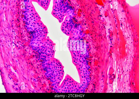 Arterien (Blutgefäße) mit Tunica adventitia, Media und Intima. Lichtmikroskop X300 mit einer Breite von 10 cm. Stockfoto