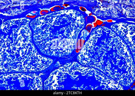 Buchlunge der Gartenspinne (Araneus sp.) Querschnitt. Lichtmikroskop X150 mit einer Breite von 10 cm. Stockfoto
